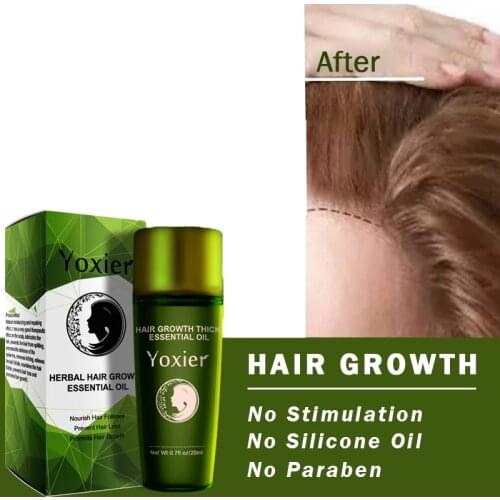 Herbal Hair Growth Essential Oil Shampoo Hair Care Styling Hair Loss Product Thick Repair Growing Treatment Liquid Free Shipping