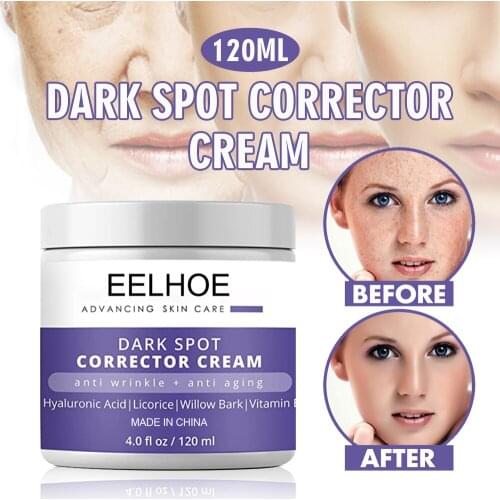 120ml Dark Spot Corrector Cream Skin Nourishing Fade Age Spots Cream Anti Aging Moisturizing Cream Skin Care Accessories