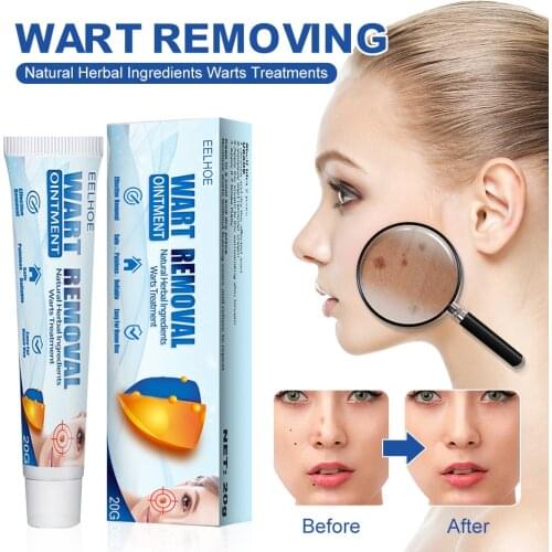 Wart remover Health Care Traditional Powerful Skin Remover Cream Safe and Effective Skin Tag, Wart, Callus, Milia for Men Women