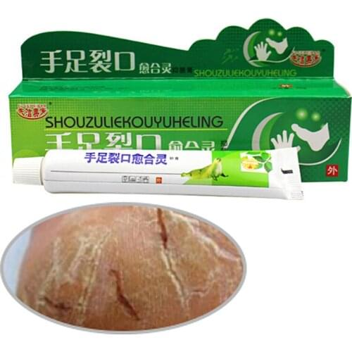 Powerful Hand Foot Crack Cream Heel Chapped Peeling Foot And Hand Repair Anti Dry Crack Skin Care Chinese Ointment