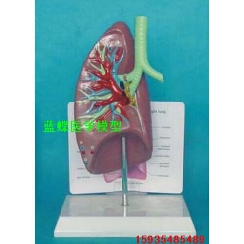 Human model Pathological lung model respiratory system Trachea and lung anatomy models free shipping