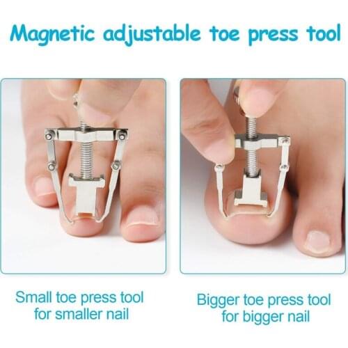 2 Pcs Ingrown Toenail Lifter Ingrown Toenail Tool Toe Clamp for Paronychia