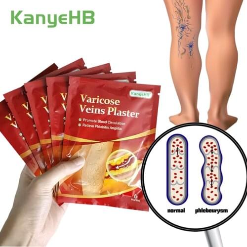 24pcs/4bags Varicose Veins Treatment Plaster Remove Varicosity Medical Patch Varication Treatment Sticker Healthcare Paste A595