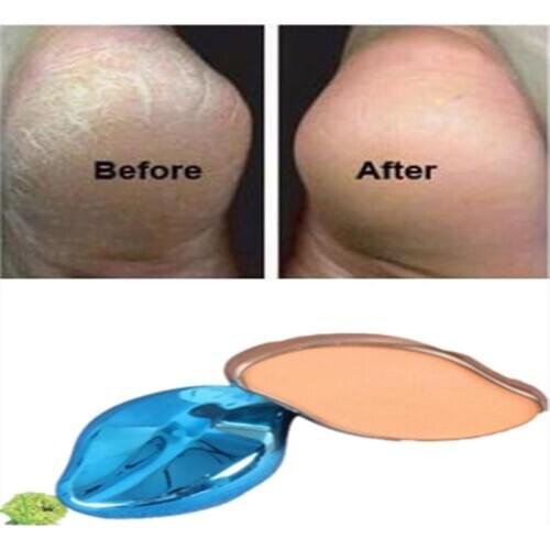 BellyLady Foot Grinder Exfoliate Foot Hard Dead Skin Pedicure Remover Pedicure Tools