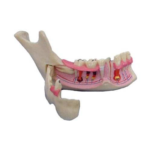 Dental Oral Practice Teeth Model Synthetic Training Model for Surgery Anatomic Mandible Model Sphenoid Modle Pink Clear Gum