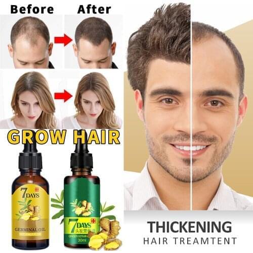 Hot sale Ginger Hair Growth Natural Repair Fast Hair Growth Fluid Hair Loss Treatment Healthy Hair Growth Liquid Biotin Essence