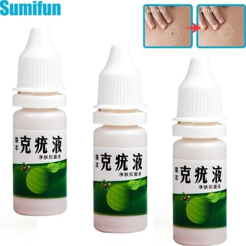 10ML Warts Liquid Skin Tag Remover Cream Against Mole Genital Flat Warts Removal Papillomas Rapidly Removes Foot Corns Relief