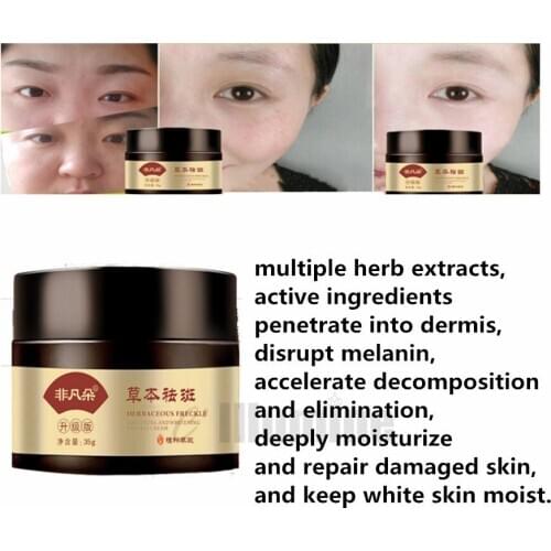 Freckle Chloasma Repair Cream Freckle Spot Removing Sunburn Spots Whiten Skin Remove Stains 35g
