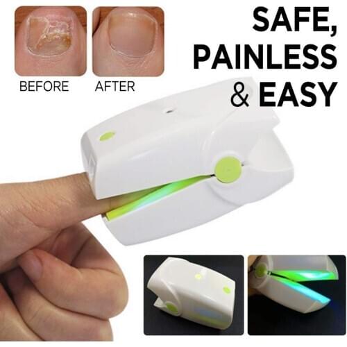 New Laser nail fungus therapy laser onychomycosis treatment 905nm Low Level Laser Therapy for Nail Fungus portable laser therapy