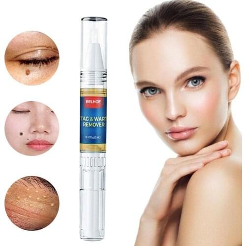 Skin beauty mole removal pen Repair No Trace Beauty Liquid Skin Treatment Papilloma Of Removal Warts Mole Pen