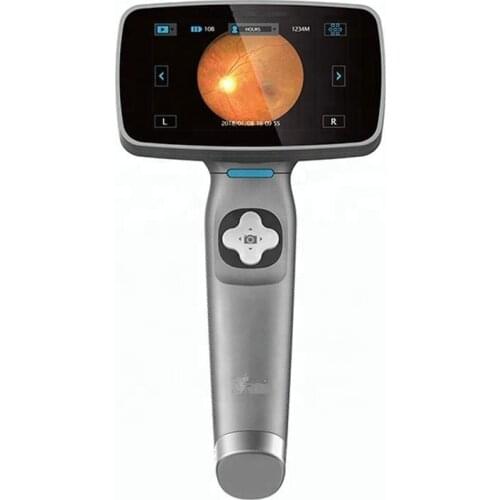 Trade assurance portable fundus camera with fast delivery