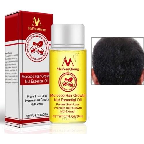 MeiYanQiong Herbal Hair Growth Treatment Thick Hair Growth Essential Oil Anti-Hair Loss Promote Hair Growth For Women And Men