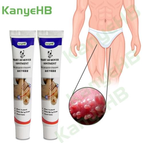 2pcs Genital Herpes Wart Remover Ointment Skin Tag Mole & Papillomas Wart Remover Condyloma Acuminatum Treatment Cream A634