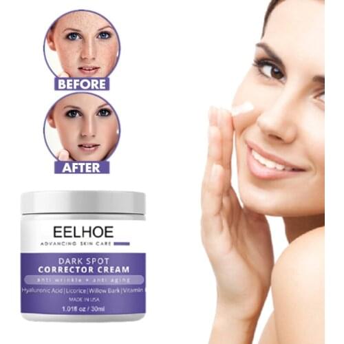 EELHOE Effective Whitening Cream Anti Wrinkle Freckle Moisturizer Melanin Melasma Acne Dark Spot Corrector Skin Care Creams 30g