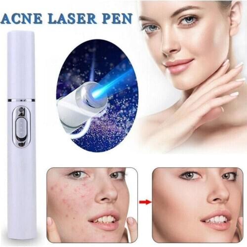 Acne Pen Portable Wrinkle Removal Machine Durable Soft Scar Remover Blue Therapy Light Pen Massage Spider Vein Eraser