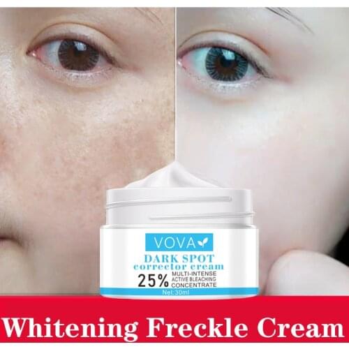 Whitening Freckle Cream Remove Melasma Acne Spot Pigment Melanin Dark Spots Pigmentation Moisturizing Gel Skin Care TSLM1