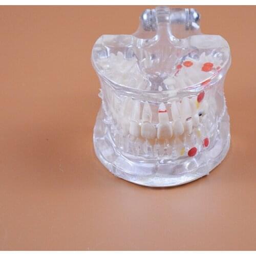 C3 Model Half Side Can Be Removable Teeth Model Used for Dental Studying, Teaching and Training