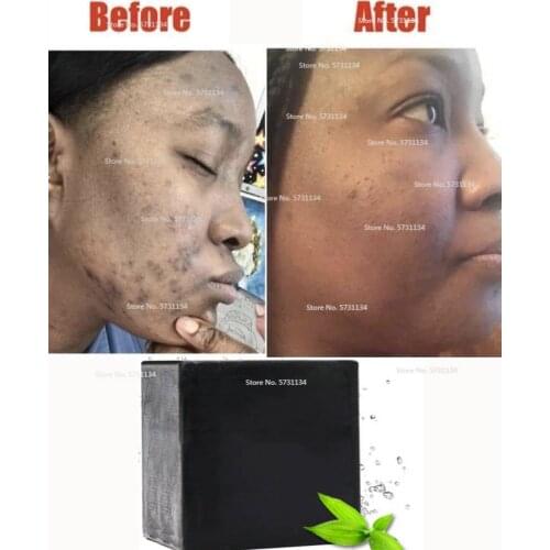 ACTIVATED BAMBOO CHARCOAL BLACK BAR SOAP - 100% Natural DEEP Detoxifying Body & Face