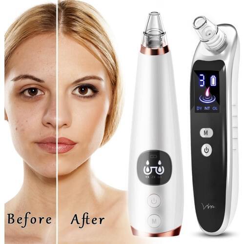 Powerful Blackhead Acne Remover Vacuum Cleaner Black Head Face Skin Care Extractor Pore Nose Lift Suction Facial Removal Massage
