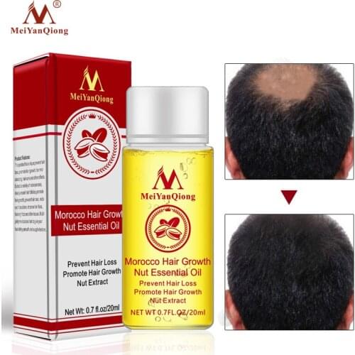 Morocco Hair Growth Nut Essence Oil Faster Grow growth Shampoo Stop Hair Loss Treatment Essence Repair Hair Loss Products