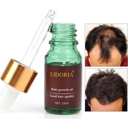 LIDORIA 10ml Powerful Hair Growth Essential Oil Hair Loss Nourishing Treatment Fast Grow Restoration Hair Care