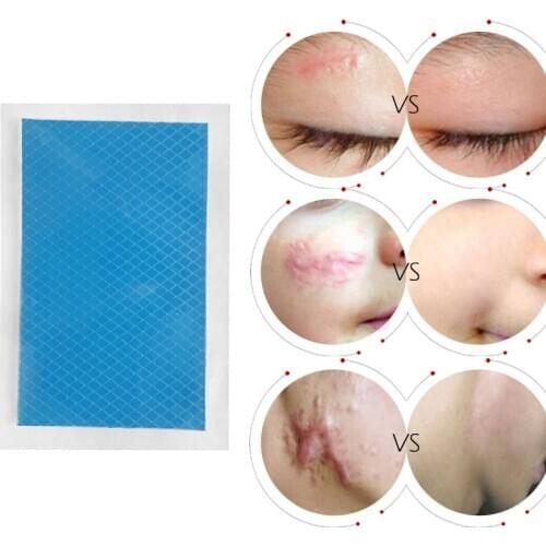 Silicone Scar Therapy Sticker Remove Trauma Burn Silicon Patch Reusable Acne Gel Skin Repair EK-New