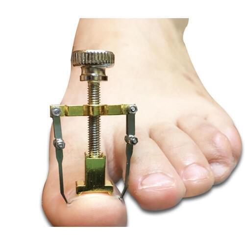 1pcs Toe Nail Corrector Pedicure Nail Tool Foot Toe Ingrown Recover Orthopedic Brace Paronychia Toenails Supplies