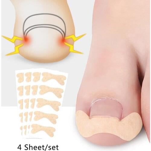 20pcs Professional Embedded Toe Nail Corrector Sticker Toenail Care Pedicure Thumb Curl Correction Sticker