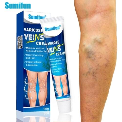 Sumifun Varicose Veins Treatment Cream Varicosity Angiitis Spider Leg Ointment Vasculitis Phlebitis Medicinal Herbal Plaster