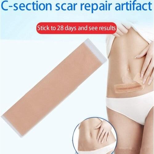 3PC Efficient Surgery Scar Removal Silicone Gel Sheet Therapy Patch for Acne Trauma Burn Scar Skin Repair Scar Treatment