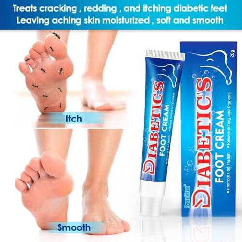 Herbal Ointment Relieve Toe Fungus Anti Fungal Infection Eczema Urticaria Beriberi Foot Care 20g Diabetic Cream For Foot Care