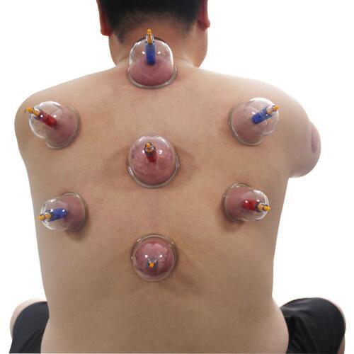 12 cups medical vacuum cupping apparatus healthy vacuum cupping kit pull out vacuum apparatus therapy relax