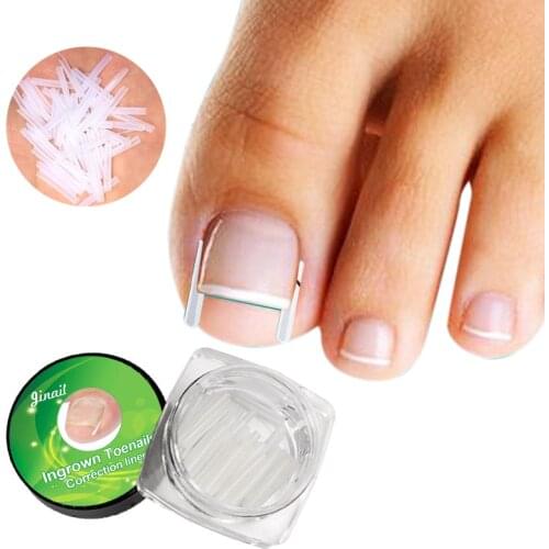 10pcs/set Ingrown Nail Pad Ortho Nail Filling Nail Groove Pad Ingrown Nail Corrector Ingrown Nail Artifact