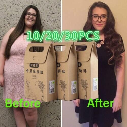 30PCS Magic Slimming Patch Chinese Medicine Weight Loss Slimming paster Slim Patchs Pads Detox Adhesive Belly Slim Fat burner