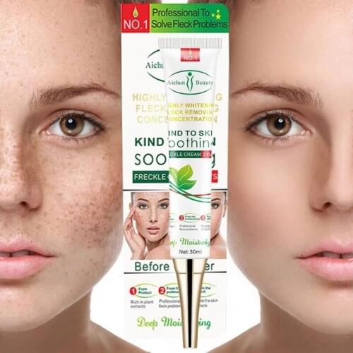 Effective Whitening Freckle Cream Remove Melasma Acne Spot Pigment Melanin Dark Spots Pigmentation Moisturizing Gel Skin Care