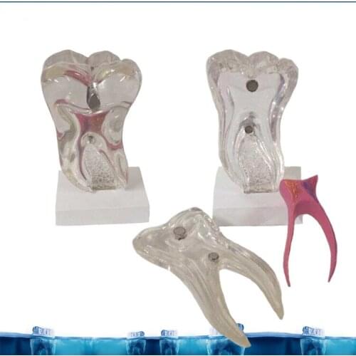 6X Six Times The Tooth Nerve Anatomy Teaching Model Pathological Dental Tooth Teeth Anatomy Model Medical Anatomy odontologia