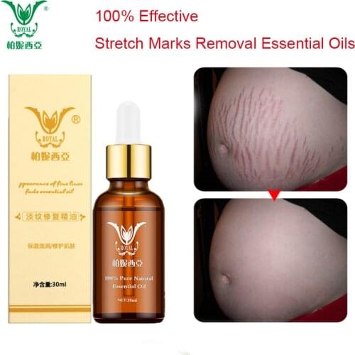 Stretch Marks Removal Essential Oils Pure Natural Stretch Marks Remover Obesity Postpartum Anti-wrinkle Repair Cream Skin Care