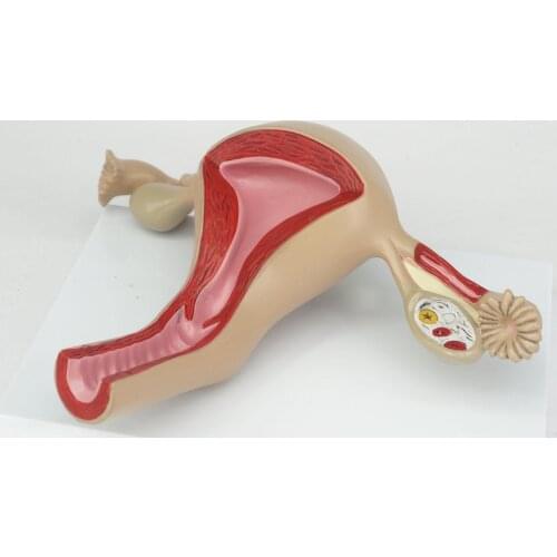 2 Part Anatomical Healthy Human Uterus and Ovary Model Female Medical Anatomy Teaching Supplies Learning Resources