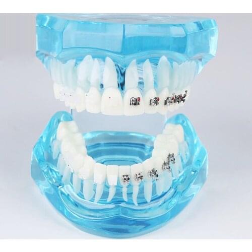 M3003 Orthodontic Demonstration Tooth Model with Half Ceramic and Half Metal Brackets