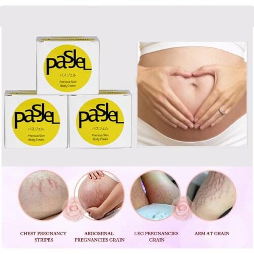 1Piece Pasjel Cream For Stretch Marks And Scar Removal Powerful To Stretch Marks Maternity Skin Body Repair Cream