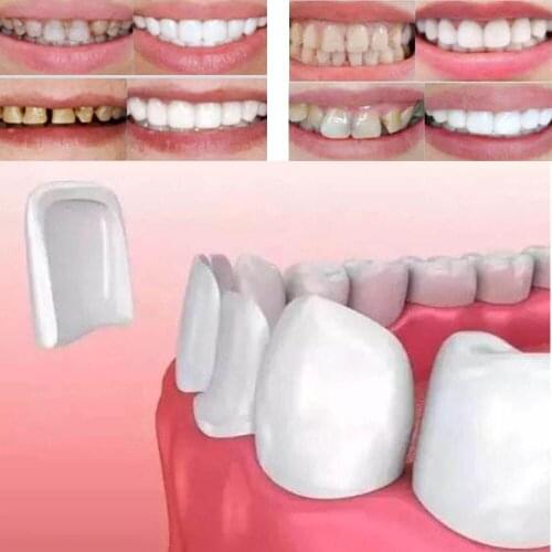 50Pcs Dental Veneers Teeth Ultra-Thin Whitening Veneers Resin Teeth Upper Anterior Teeth Beauty Health Tools