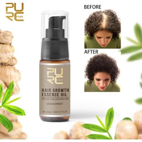 PURC Fast Hair Growth Essence Oil Anti-hair Loss Nutrient Solution Help For Hair Growth Hair Treatment Product 20ml