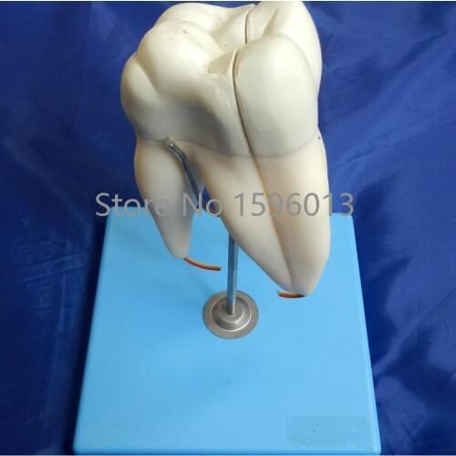 Lower First Upper Molar with Three Roots model, Molar teeth model,dental model