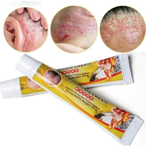 1Pcs Tiger Balm Eczema Cream Psoriasis Antibacterial Dermatitis Pruritus Eczematoid Herbal Anti-itching Medical Ointment
