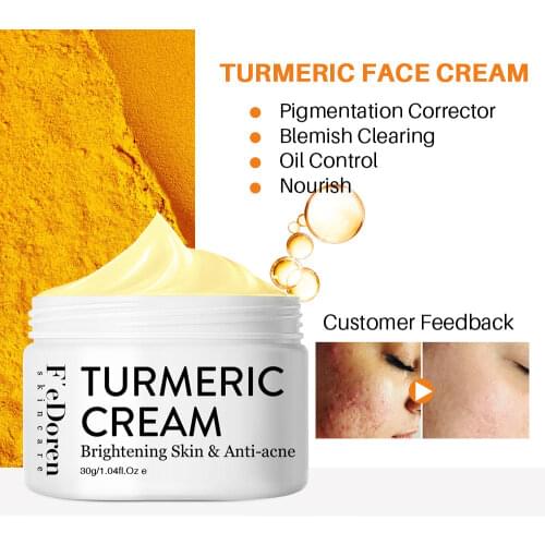 Hot Sale 30ml Turmeric Face Cream Repair Acnes scar Dark spot Treatment Moisturizer Whitening Lightening Against Acne Skin care