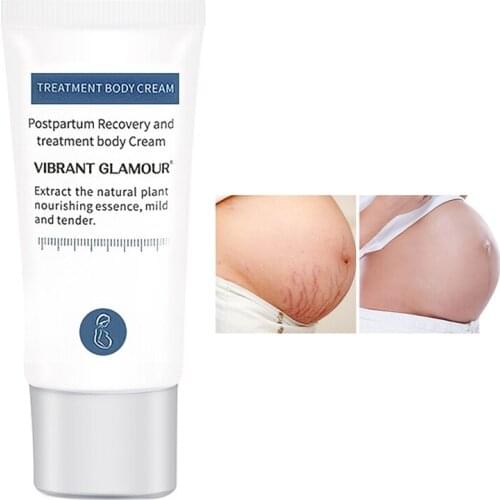 Stretch Mark Remover Cream Removal Scar Cream For Pregnant Women To Improve Wrinkles Skin Cream For Stretch Marks Scar Remova