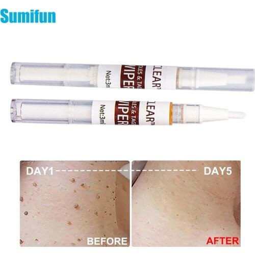 1pcs Warts Removal Pen Mole Freckle Wart Skin Tag Remover Dark Spot Corn Calluses Warts Pain Relief Skin Care Plaster C2545