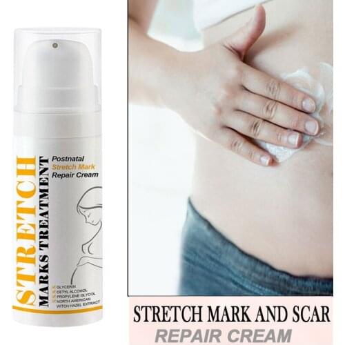 GreenPeople Natural Mild Non-irritating Stretch Mark Cream For Pregnancy Repair Scar Slack Line Abdomen Stretch Marks Cream
