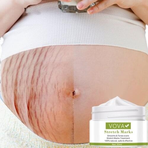 VOVA Removes Stretch Mark Cream To Remove Postpartum Obesity Pregnant Women Repair Anti-Aging Anti-Winkles Firming Body Cream