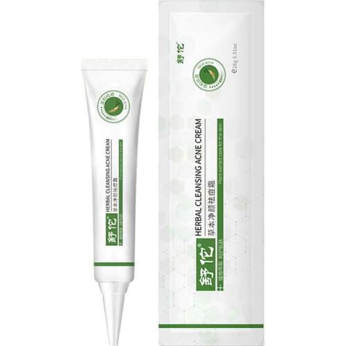 26g Natural Acne Spot Treatment Cream Rapid Acne Removing Eliminate Acne Blain Deep Cleansing Repairing Skin Care Whitening